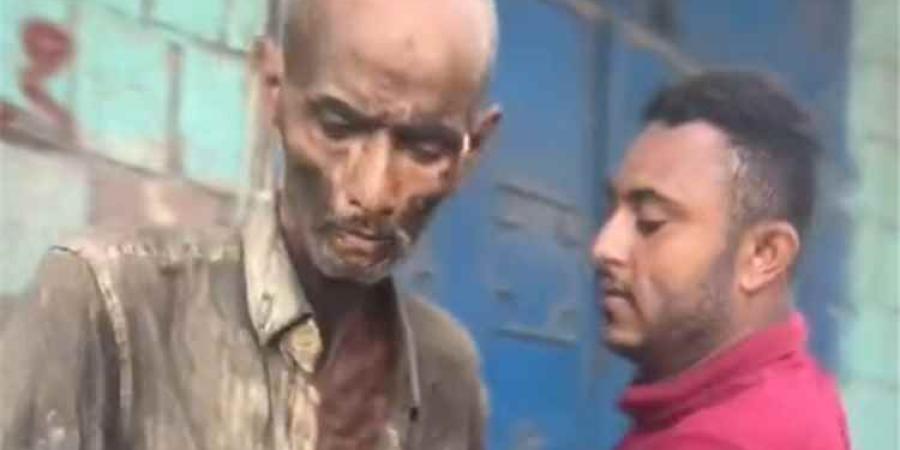 نداء إلى أبناء مصر.. طبيب عظام شهير بالحديدة يعاني من اعتلال نفسي ومناشدات عاجلة للتعرف عليه لنقله إلى وطنه - [فيديو]